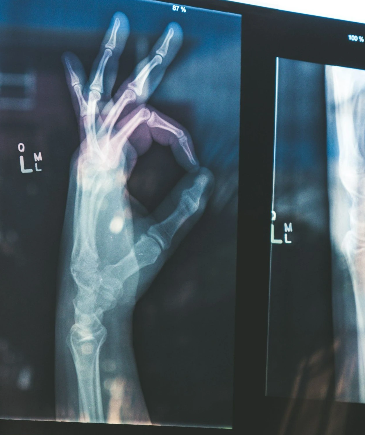 citiscan result hand ok